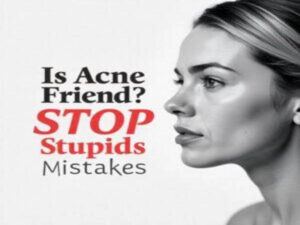 Is Acne your friend,STOP Making these Stupid Mistakes