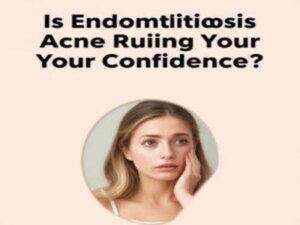 Is Endometriosis Acne Ruining Your Confidence